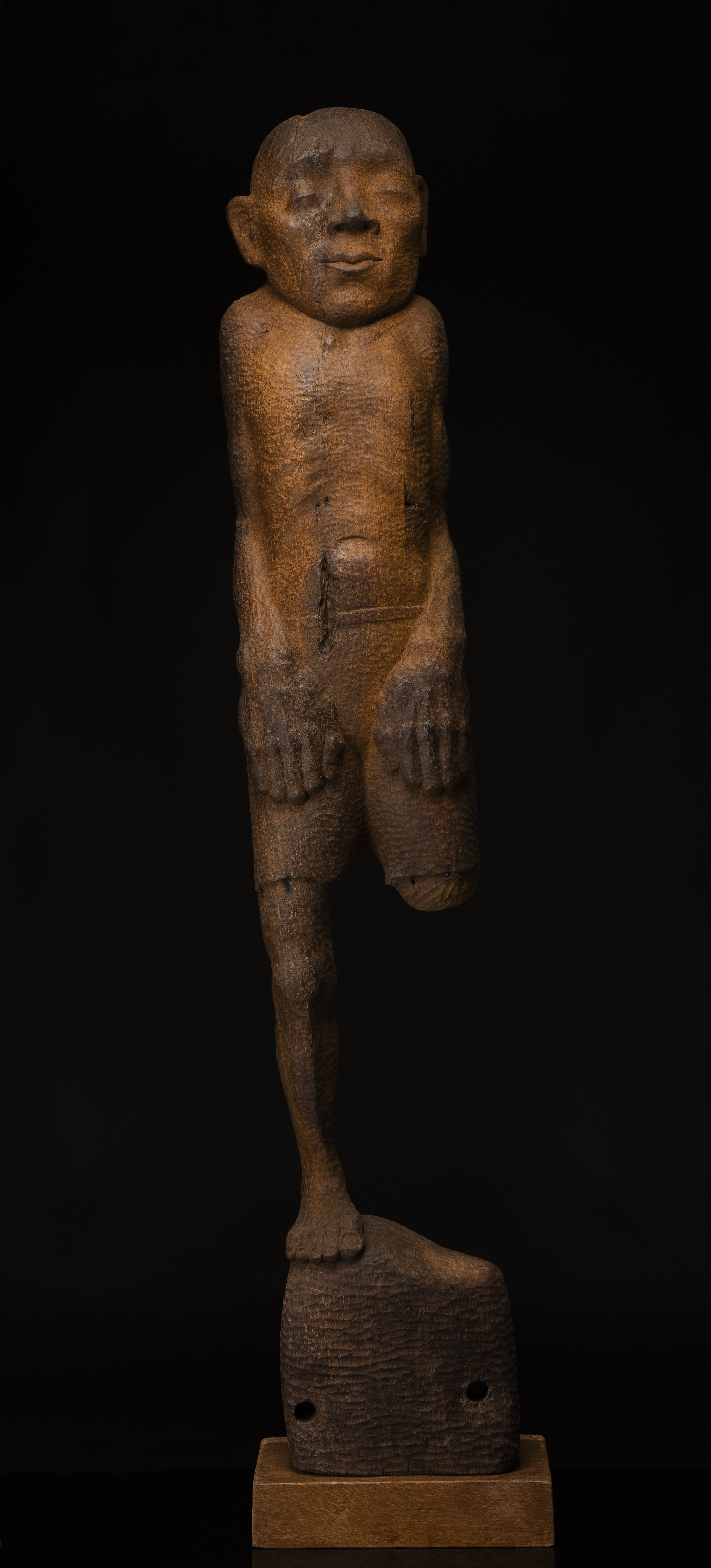 Lost leg